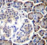 SMAP2 Antibody - SMAP2 Antibody immunohistochemistry of formalin-fixed and paraffin-embedded human pancreas tissue followed by peroxidase-conjugated secondary antibody and DAB staining.