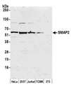 SMAP2 Antibody - Detection of human and mouse SMAP2 by western blot. Samples: Whole cell lysate (50 µg) from HeLa, HEK293T, Jurkat, mouse TCMK-1, and mouse NIH 3T3 cells prepared using NETN lysis buffer. Antibody: Affinity purified rabbit anti-SMAP2 antibody used for WB at 1:1000. Detection: Chemiluminescence with an exposure time of 3 minutes.