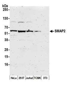 SMAP2 Antibody - Detection of human and mouse SMAP2 by western blot. Samples: Whole cell lysate (50 µg) from HeLa, HEK293T, Jurkat, mouse TCMK-1, and mouse NIH 3T3 cells prepared using NETN lysis buffer. Antibody: Affinity purified rabbit anti-SMAP2 antibody used for WB at 1:1000. Detection: Chemiluminescence with an exposure time of 3 minutes.