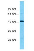 SMAP2 Antibody - SMAP2 antibody Western Blot of U937. Antibody dilution: 1 ug/ml.  This image was taken for the unconjugated form of this product. Other forms have not been tested.