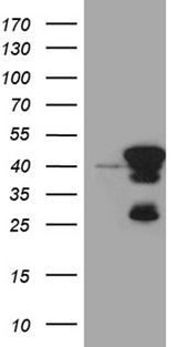 SMAP2 Antibody - HEK293T cells were transfected with the pCMV6-ENTRY control. (Left lane) or pCMV6-ENTRY SMAP2. (Right lane) cDNA for 48 hrs and lysed. Equivalent amounts of cell lysates. (5 ug per lane) were separated by SDS-PAGE and immunoblotted with anti-SMAP2. (1:2000)