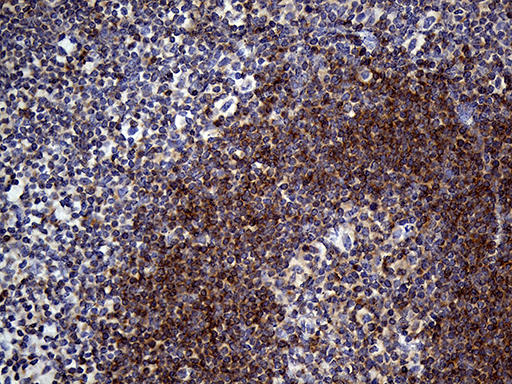 SMAP2 Antibody - Immunohistochemical staining of paraffin-embedded Human tonsil within the normal limits using anti-SMAP2 mouse monoclonal antibody. (Heat-induced epitope retrieval by 1mM EDTA in 10mM Tris buffer. (pH8.5) at 120°C for 3 min. (1:500)
