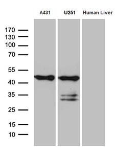 SMAP2 Antibody - Western blot analysis of extracts. (35ug) from 2 different cell lines and human liver tissue lysate by using anti-SMAP2 monoclonal antibody. (1:500)