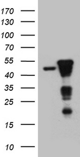 SMAP2 Antibody - HEK293T cells were transfected with the pCMV6-ENTRY control. (Left lane) or pCMV6-ENTRY SMAP2. (Right lane) cDNA for 48 hrs and lysed. Equivalent amounts of cell lysates. (5 ug per lane) were separated by SDS-PAGE and immunoblotted with anti-SMAP2. (1:2000)