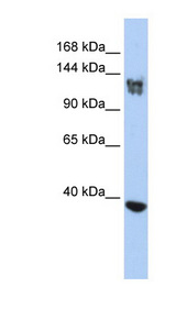 SMARCA1 / SWI Antibody - SMARCA1 antibody Western blot of Jurkat lysate. This image was taken for the unconjugated form of this product. Other forms have not been tested.
