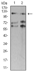 SMARCA1 / SWI Antibody - Western blot analysis using SMARCA1 mouse mAb against SW620 (1) and HT-29 (2) cell lysate.