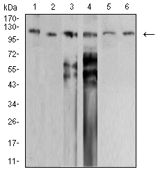 SMARCA1 / SWI Antibody - Western blot analysis using SMARCA1 mouse mAb against PANC-1 (1), HEK293 (2), SW620 (3), HT-29 (4), SH-SY5Y (5), and SK-OV-3 (6) cell lysate.