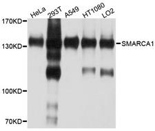 SMARCA1 / SWI Antibody - Western blot analysis of extracts of various cell lines, using SMARCA1 antibody at 1:1000 dilution. The secondary antibody used was an HRP Goat Anti-Rabbit IgG (H+L) at 1:10000 dilution. Lysates were loaded 25ug per lane and 3% nonfat dry milk in TBST was used for blocking. An ECL Kit was used for detection and the exposure time was 15s.