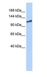 SMARCA1 / SWI Antibody - SMARCA1 / SWI antibody Western Blot of 293T.  This image was taken for the unconjugated form of this product. Other forms have not been tested.