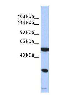 SMARCA2 / BRM Antibody - Western blot of Human Jurkat. SMARCA2 antibody dilution 1.0 ug/ml.  This image was taken for the unconjugated form of this product. Other forms have not been tested.