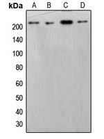 SMARCA2 / BRM Antibody - Western blot analysis of BRM expression in HepG2 (A); HeLa (B); THP1 (C); NIH3T3 (D) whole cell lysates.