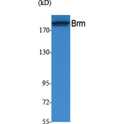 SMARCA2 / BRM Antibody - Western blot of Brm antibody