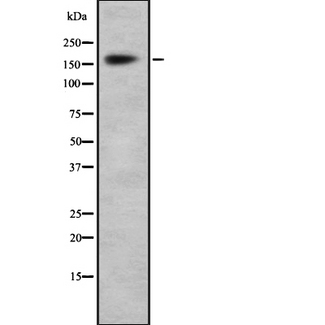 SMARCA2 / BRM Antibody - Western blot analysis of Brm using HuvEc whole cells lysates