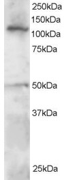 SMARCA3 / HLTF Antibody - Antibody staining (0.5 ug/ml) of Jurkat lysate (RIPA buffer, 30 ug total protein per lane). Primary incubated for 1 hour. Detected by Western blot of chemiluminescence.