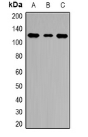 SMARCA3 / HLTF Antibody - Western blot analysis of HLTF expression in HEK293T (A); A549 (B); HeLa (C) whole cell lysates.