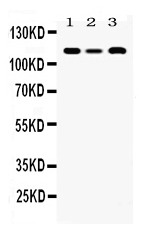 SMARCA3 / HLTF Antibody - Western blot - Anti-HLTF Picoband Antibody