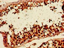 SMARCA3 / HLTF Antibody - Immunohistochemistry image of paraffin-embedded human testis tissue at a dilution of 1:100