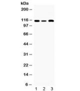 SMARCA3 / HLTF Antibody - Western blot testing of 1) rat heart, 2) mouse spleen and 3) human placenta lysate with HLTF antibody at 0.5ug/ml. Predicted/observed molecular weight: ~114 kDa.