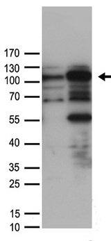 SMARCA3 / HLTF Antibody - HEK293T cells were transfected with the pCMV6-ENTRY control. (Left lane) or pCMV6-ENTRY HLTF. (Right lane) cDNA for 48 hrs and lysed