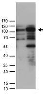 SMARCA3 / HLTF Antibody - HEK293T cells were transfected with the pCMV6-ENTRY control. (Left lane) or pCMV6-ENTRY HLTF. (Right lane) cDNA for 48 hrs and lysed