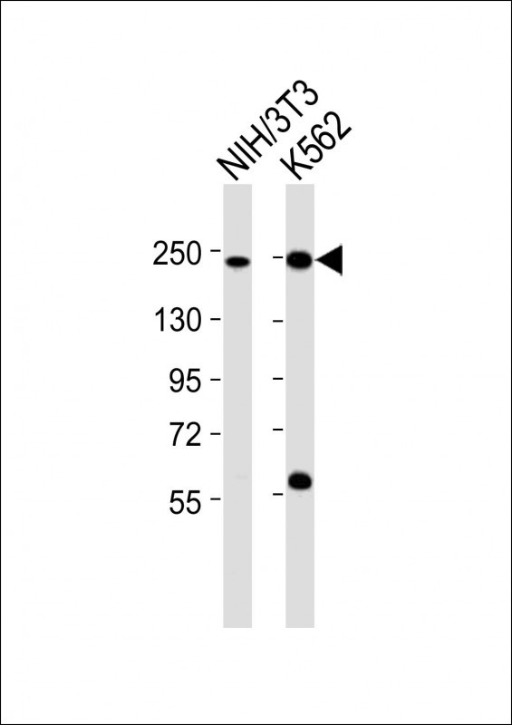 SMARCA4 / BRG1 Antibody - All lanes : Anti-Smarca4 Antibody at 1:2000 dilution Lane 1: NIH/3T3 whole cell lysates Lane 2: K562 whole cell lysates Lysates/proteins at 20 ug per lane. Secondary Goat Anti-Rabbit IgG, (H+L), Peroxidase conjugated at 1/10000 dilution Predicted band size : 181 kDa Blocking/Dilution buffer: 5% NFDM/TBST.