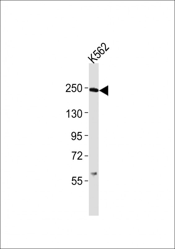 SMARCA4 / BRG1 Antibody - Anti-Smarca4 Antibody at 1:2000 dilution + K562 whole cell lysates Lysates/proteins at 20 ug per lane. Secondary Goat Anti-Rabbit IgG, (H+L), Peroxidase conjugated at 1/10000 dilution Predicted band size : 181 kDa Blocking/Dilution buffer: 5% NFDM/TBST.