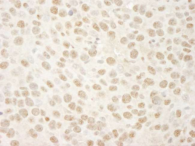 SMARCA4 / BRG1 Antibody - Detection of Mouse BRG1/SMARCA4 by Immunohistochemistry. Sample: FFPE section of mouse colon carcinoma. Antibody: Affinity purified rabbit anti-BRG1/SMARCA4 used at a dilution of 1:250. Epitope Retrieval Buffer-High pH (IHC-101J) was substituted for Epitope Retrieval Buffer-Reduced pH.