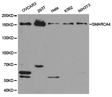 SMARCA4 / BRG1 Antibody - Western blot of extracts of various cell lines, using SMARCA4 antibody.