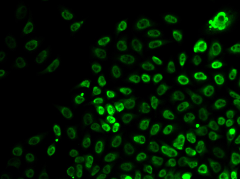 SMARCA4 / BRG1 Antibody - Immunofluorescence analysis of HeLa cells.