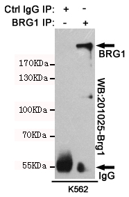 SMARCA4 / BRG1 Antibody - Immunoprecipitation analysis of HeLa cells lysates. IP: BRG1 mouse monoclonal antibody(200282); WB: BRG1 mouse monoclonal antibody(201025).