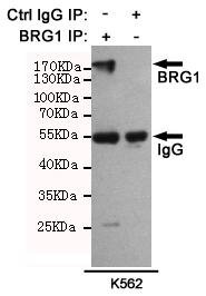 SMARCA4 / BRG1 Antibody - Immunoprecipitation analysis of K562 cell lysates using BRG1 mouse monoclonal antibody (201025).