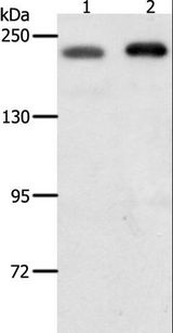 SMARCA4 / BRG1 Antibody - Western blot analysis of HeLa and Jurkat cell, using SMARCA4 Polyclonal Antibody at dilution of 1:700.