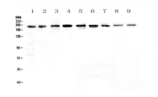 SMARCA4 / BRG1 Antibody - Western blot - Anti-BRG1 Picoband antibody