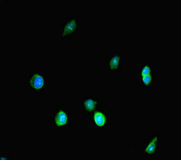 SMARCA4 / BRG1 Antibody - Immunofluorescent analysis of HepG-2 cells diluted at 1:100 and Alexa Fluor 488-congugated AffiniPure Goat Anti-Rabbit IgG(H+L)