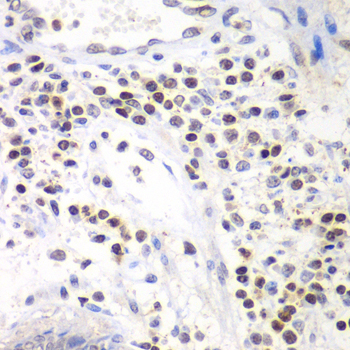 SMARCA4 / BRG1 Antibody - Immunohistochemistry of paraffin-embedded human colon using SMARCA4 antibody at dilution of 1:100 (40x lens).