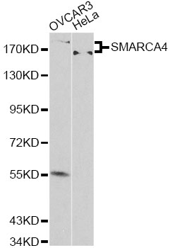 SMARCA4 / BRG1 Antibody - Western blot analysis of extracts of various cell lines, using SMARCA4 antibody at 1:500 dilution. The secondary antibody used was an HRP Goat Anti-Rabbit IgG (H+L) at 1:10000 dilution. Lysates were loaded 25ug per lane and 3% nonfat dry milk in TBST was used for blocking.