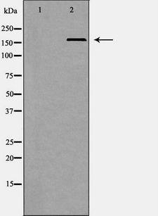 SMARCA4 / BRG1 Antibody - Western blot analysis of HepG2 whole cells lysates using SMARCA4 antibody. The lane on the left is treated with the antigen-specific peptide.