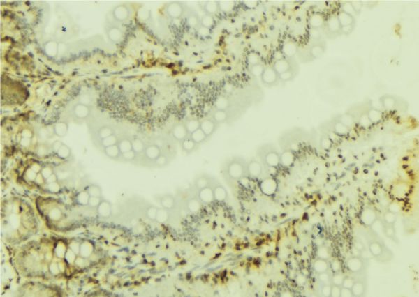 SMARCA4 / BRG1 Antibody - 1:100 staining mouse colon tissue by IHC-P. The sample was formaldehyde fixed and a heat mediated antigen retrieval step in citrate buffer was performed. The sample was then blocked and incubated with the antibody for 1.5 hours at 22°C. An HRP conjugated goat anti-rabbit antibody was used as the secondary.