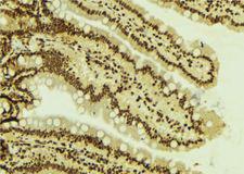 SMARCA4 / BRG1 Antibody - 1:100 staining mouse colon tissue by IHC-P. The sample was formaldehyde fixed and a heat mediated antigen retrieval step in citrate buffer was performed. The sample was then blocked and incubated with the antibody for 1.5 hours at 22°C. An HRP conjugated goat anti-rabbit antibody was used as the secondary.