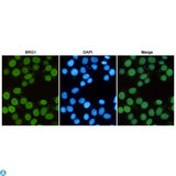 SMARCA4 / BRG1 Antibody - Immunofluorescent analysis of Hela cells fixed with 4% Paraformaldehyde and using anti-BRG1 mouse mAb (dilution 1:50). DAPI was used to stain nucleus (blue).