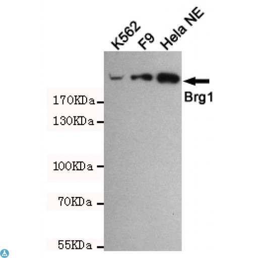 SMARCA4 / BRG1 Antibody - Western blot detection of BRG1 in Hela NE, F9 and K562 cell lysates using BRG1 mouse mAb (1:1000 diluted). Predicted band size: 220KDa. Observed band size: 220KDa.