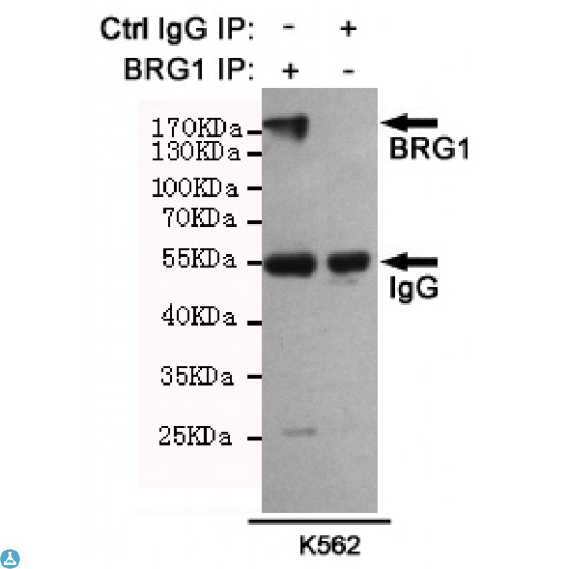 SMARCA4 / BRG1 Antibody - Immunoprecipitation analysis of K562 cell lysates using BRG1 mouse mAb (201025).