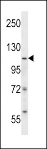 SMARCA5 / SNF2H Antibody - ISWI Antibody western blot of SK-BR-3 cell line lysates (35 ug/lane). The ISWI antibody detected the ISWI protein (arrow).