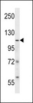 SMARCA5 / SNF2H Antibody - ISWI Antibody western blot of SK-BR-3 cell line lysates (35 ug/lane). The ISWI antibody detected the ISWI protein (arrow).