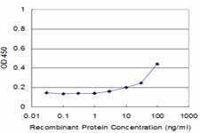 SMARCA5 / SNF2H Antibody - Detection limit for recombinant GST tagged SMARCA5 is approximately 3 ng/ml as a capture antibody.