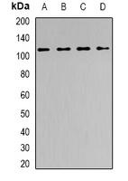 SMARCA5 / SNF2H Antibody - Western blot analysis of SNF2H expression in PC3 (A); HepG2 (B); mouse spleen (C); mouse brain (D) whole cell lysates.
