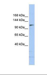 SMARCA5 / SNF2H Antibody - NTERA2 cell lysate. Antibody concentration: 1.0 ug/ml. Gel concentration: 6%-18%.  This image was taken for the unconjugated form of this product. Other forms have not been tested.