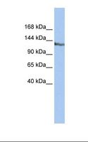SMARCAD1 Antibody - HepG2 cell lysate. Antibody concentration: 1.0 ug/ml. Gel concentration: 6-18%.  This image was taken for the unconjugated form of this product. Other forms have not been tested.