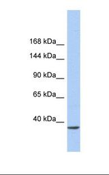 SMARCAD1 Antibody - Fetal heart lysate. Antibody concentration: 1.0 ug/ml. Gel concentration: 6-18%.  This image was taken for the unconjugated form of this product. Other forms have not been tested.