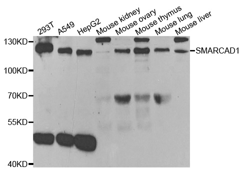 SMARCAD1 Antibody - Western blot analysis of extracts of various cell lines.